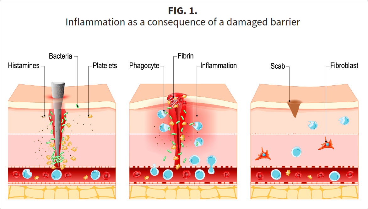 Fig-1-A2 Three stars of corneotherapy —  barrier lipids, antioxidants & hyaluronic acid