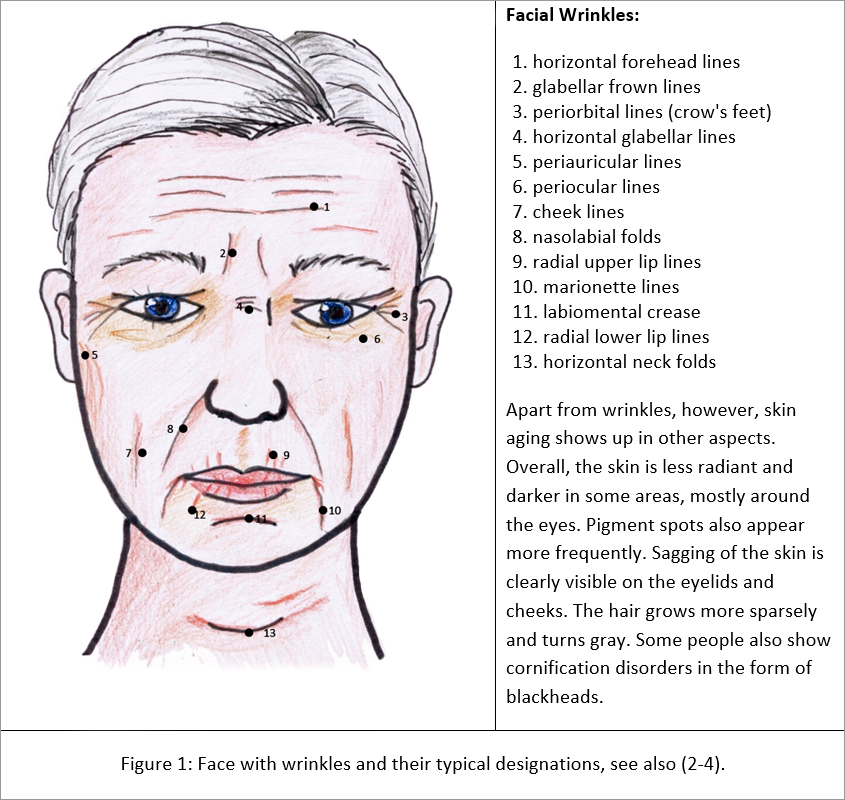 Classification of wrinkles