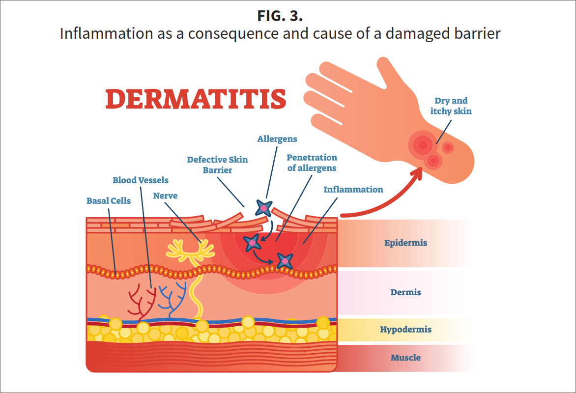 Fig-3-A2 Three stars of corneotherapy —  barrier lipids, antioxidants & hyaluronic acid