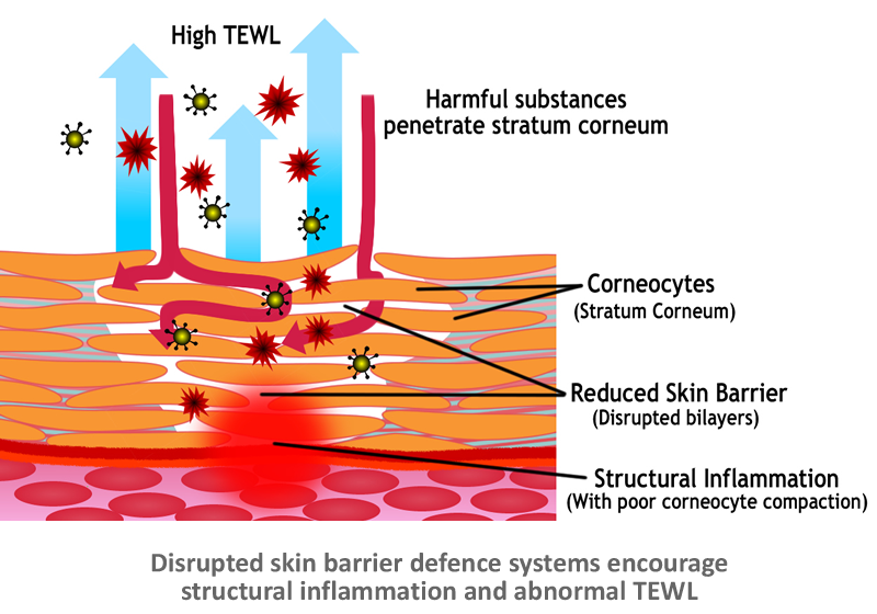Disrupted skin barrier